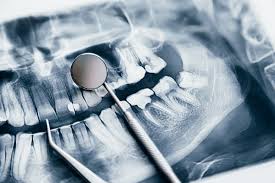 Oral Surgery